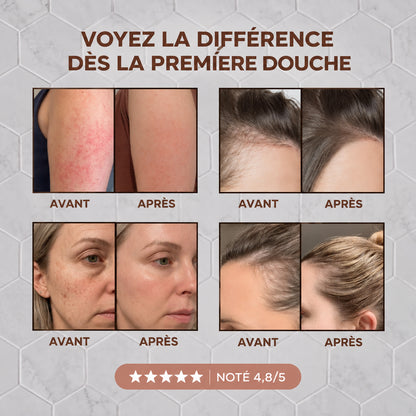 Transformez vos cheveux, votre peau et votre douche avec Zonirya™