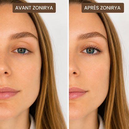 Recourbe-Cils Zonirya™